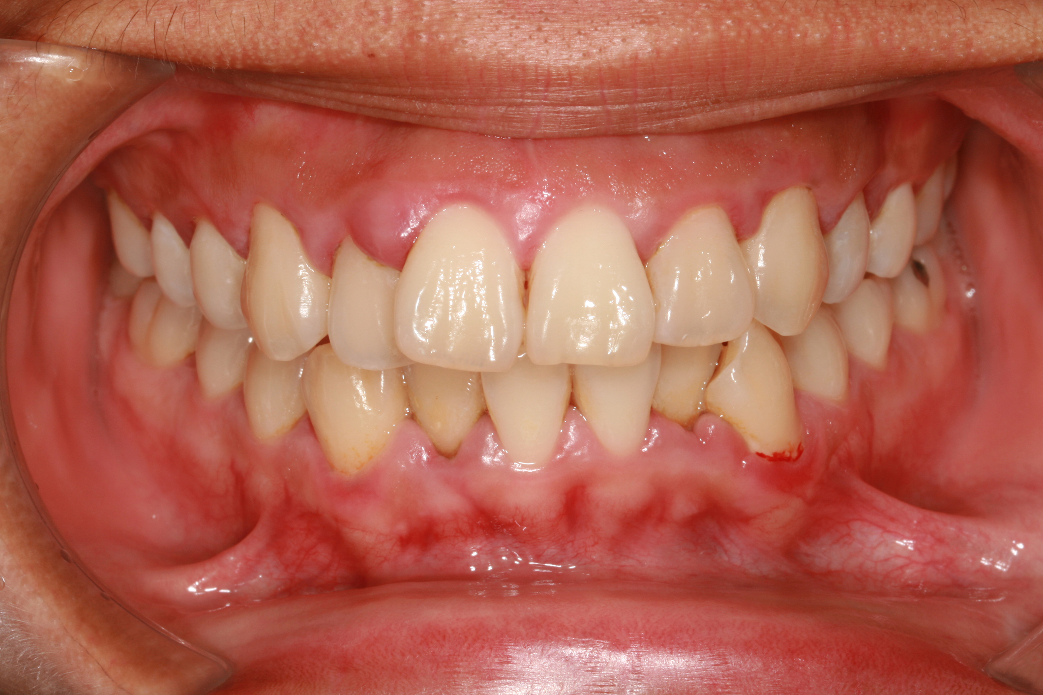 Parodontologie à Jodoigne